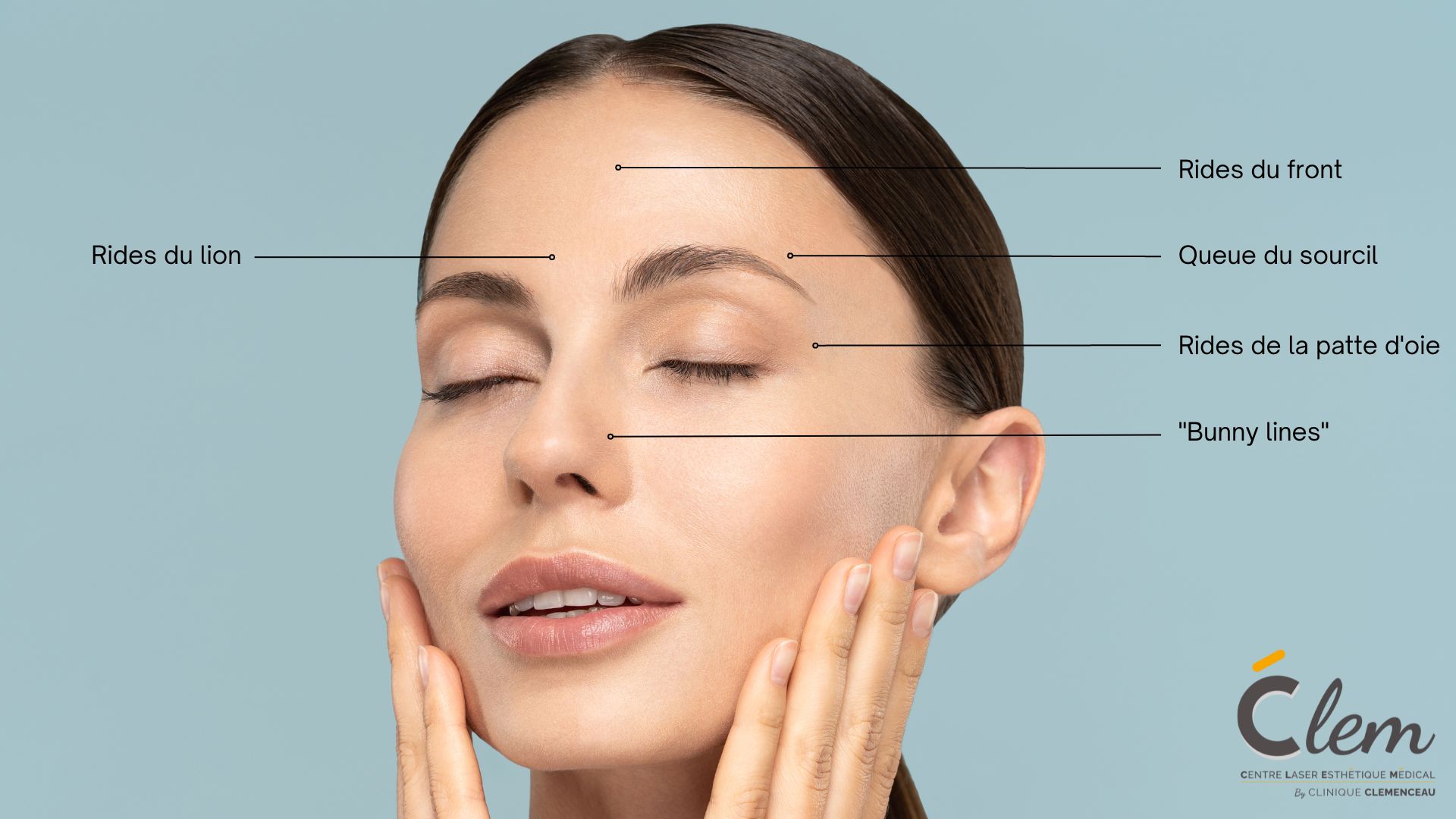Les Injections de Botox en Médecine Esthétique
