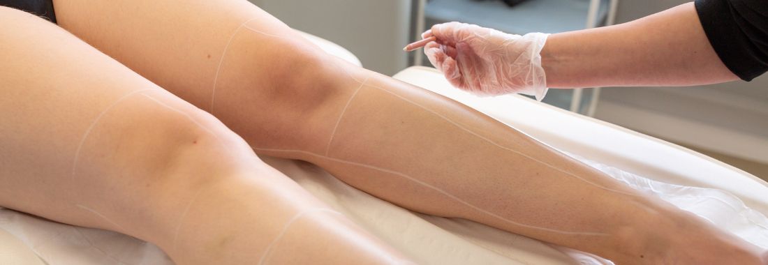 epilation-laser-definitive-jambes-lille