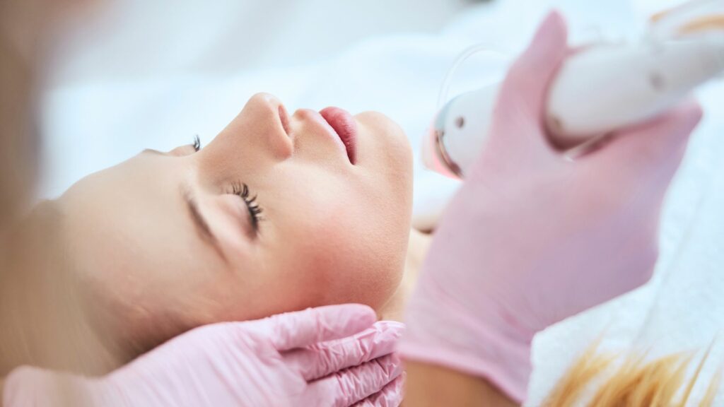 Radiofréquence microneedling Potenza à Lille