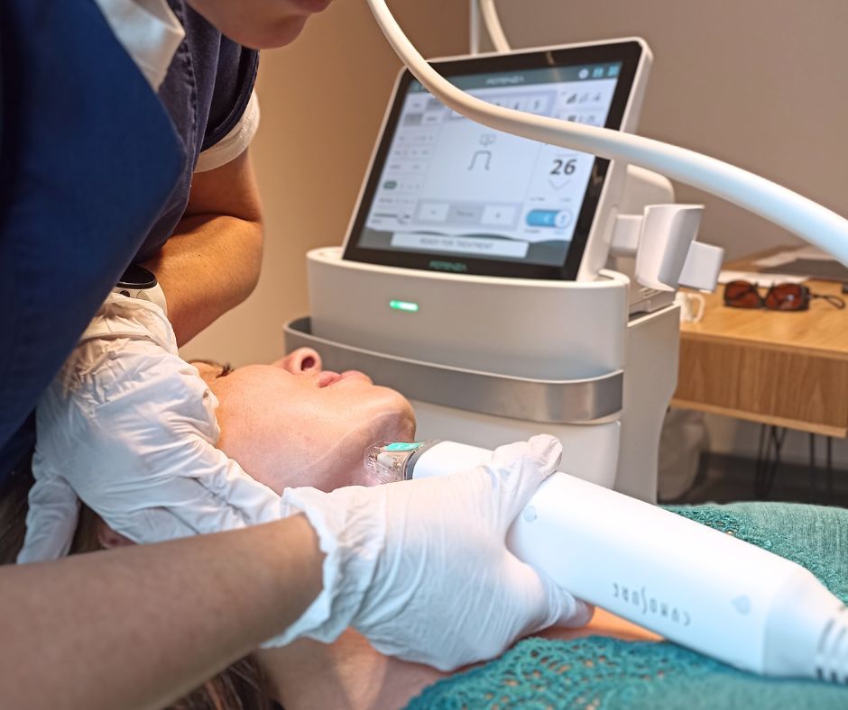 La radiofréquence microneedling Potenza à la clinique CLEM