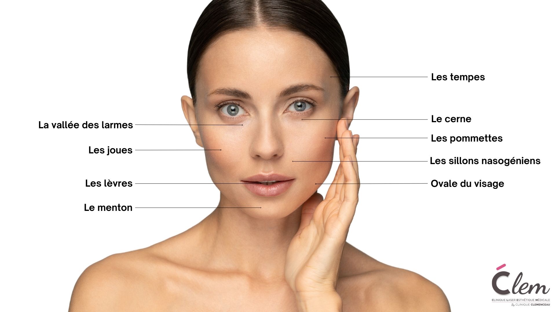 Zones d'injections à l'acide hyaluronique