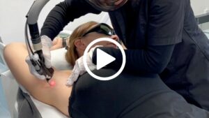 Visionnez une séance d'épilation au laser dans cette vidéo à la clinique CLEM de Lille